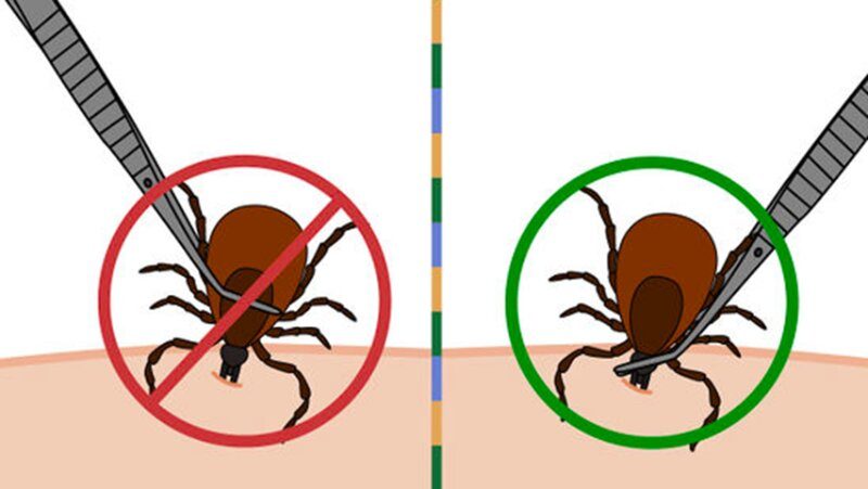 Removal Tips
