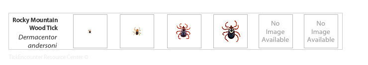 Rocky Mountain Wood Tick